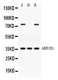 WB - Anti-AKR1B1 Picoband Antibody ABO11653